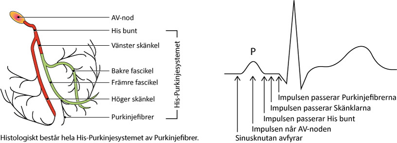 Figur 92. Retledningskomponenter och relation till EKG-kurvan. Delvis efter Chous’s Electrocardiography in clinical practice, av B. Surawicz & Timothy Knilans; Elsevier 2008.
