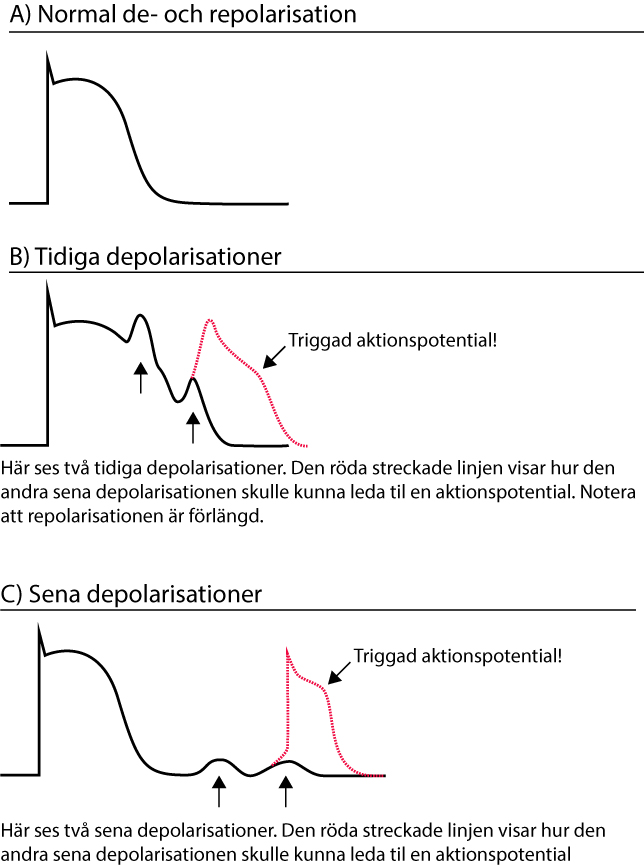 Efterdepolarisationer som leder till triggade aktionspotentialer.