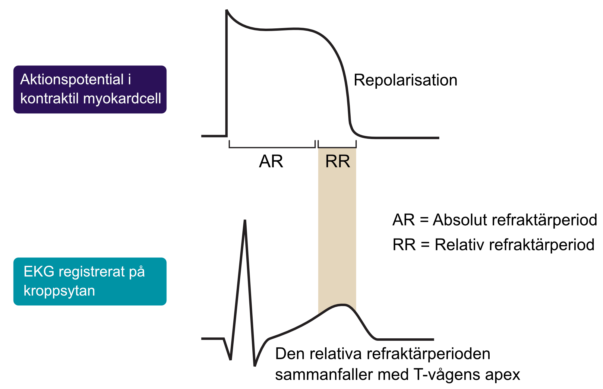 Figur 2. Absolut och relativ refraktärperiod under aktionspotentialen. Den relativa refraktärperioden är en känslig fas i hjärtcykeln då en elektrisk stimulering kan föranleda ett kammarflimmer. Den relativa refraktärperioden sammanfaller med T-vågens apex.
