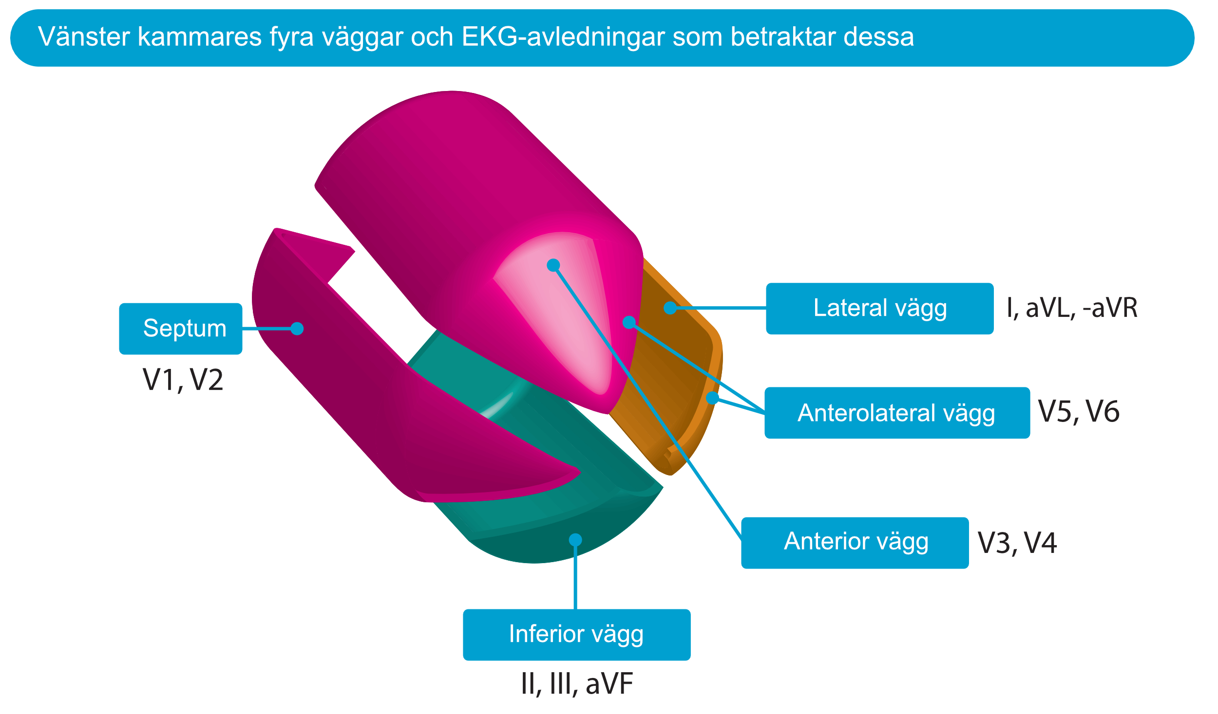 Figur 5. Vänster kammares form påminner om en pistolkula. Kammaren kan delas in i fyra väggar och figuren visar EKG-avledningarna som betraktar respektive vägg.