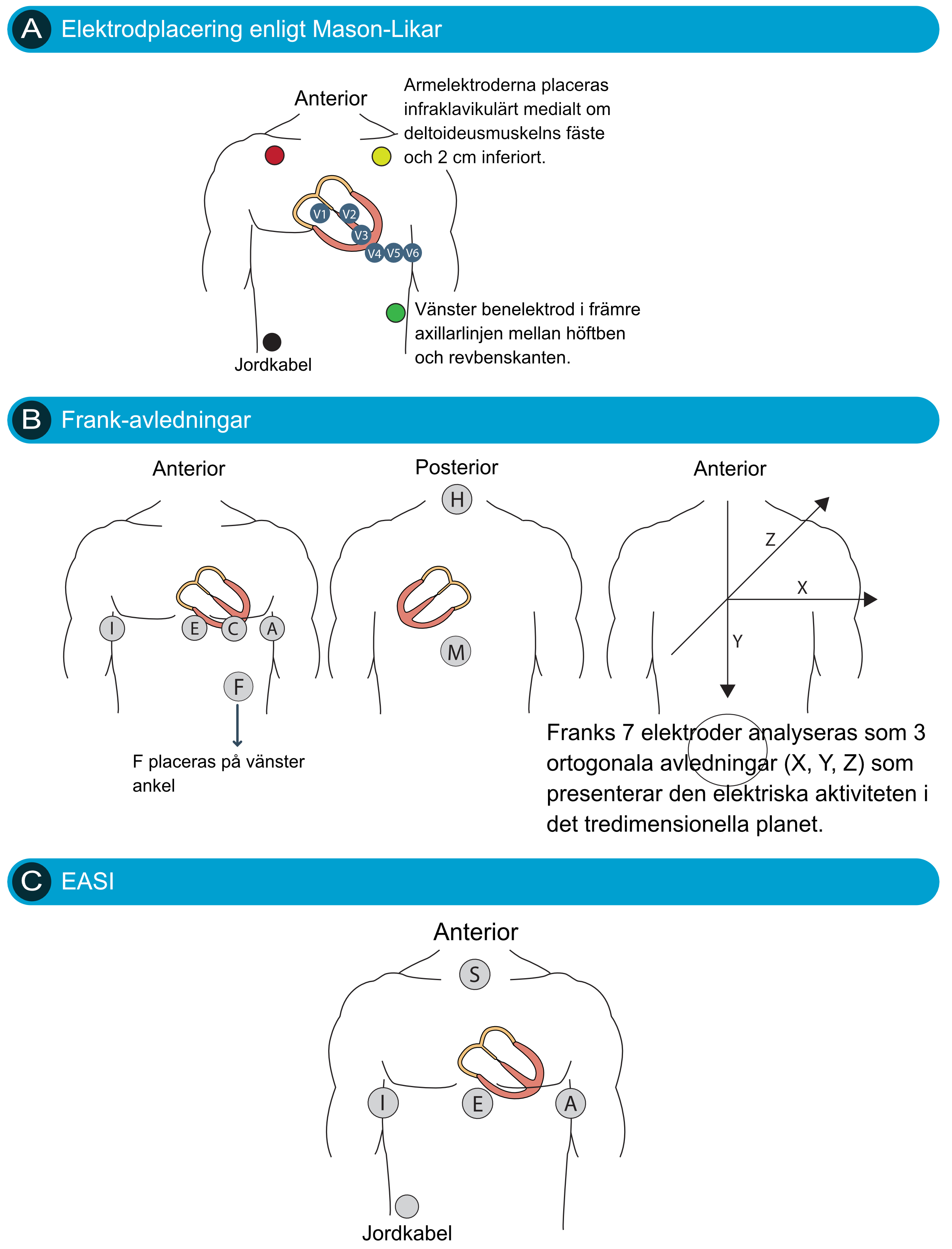 Figur 18. Alternativa avledningssystem.