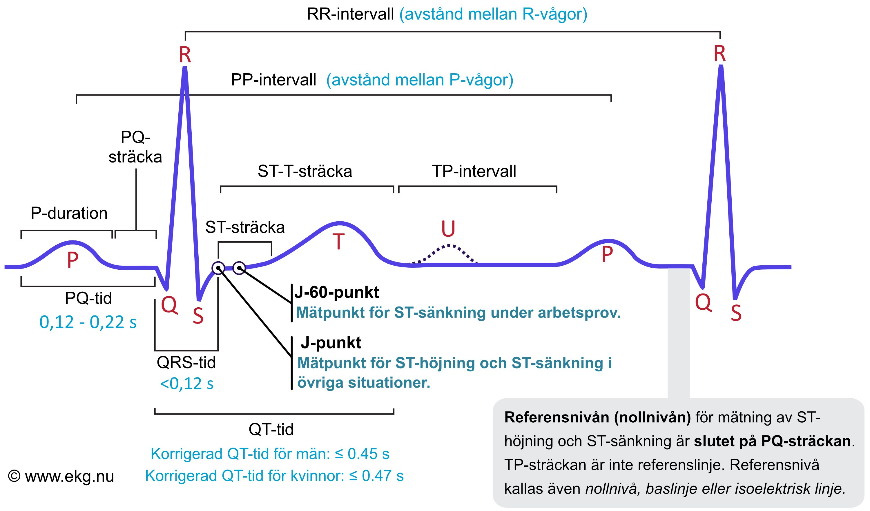 Figur 1. Den klassiska EKG-kurvan. Kammarkomplexet kallas även QRS-komplex, oavsett om det saknas någon av vågorna, Q, R eller S.