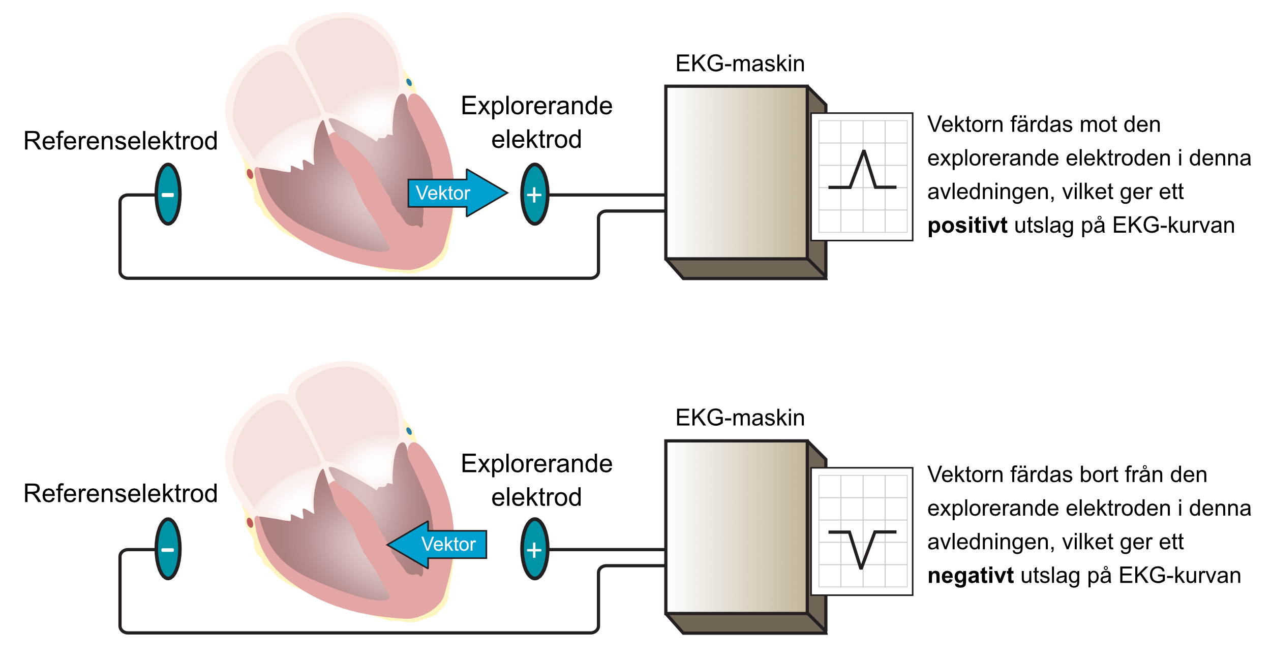 Figur 6. Varje EKG-kurva representerar en avledning. Minst två elektroder ingår i en avledning eftersom det behövs en explorerande elektrod samt en referens.