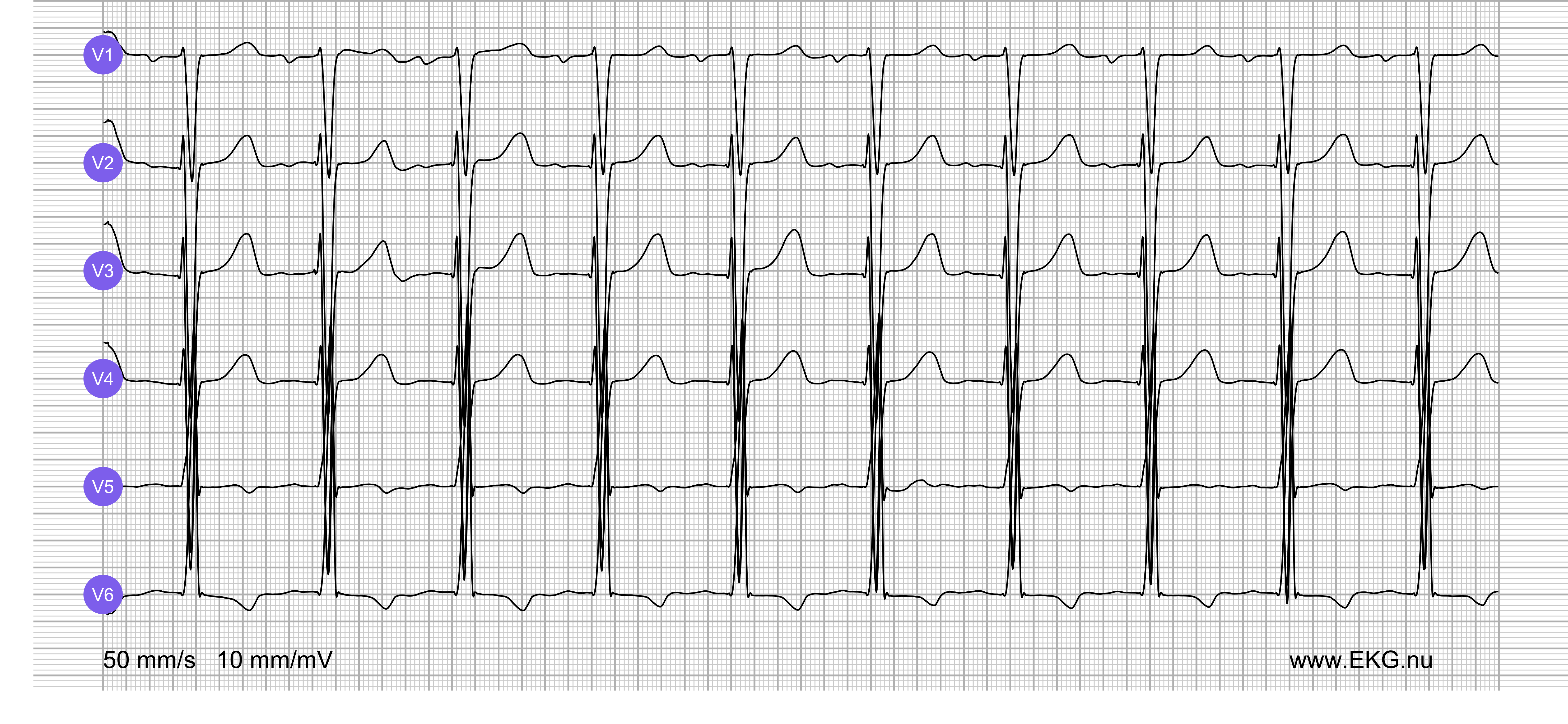 EKG test bok kurs 6a