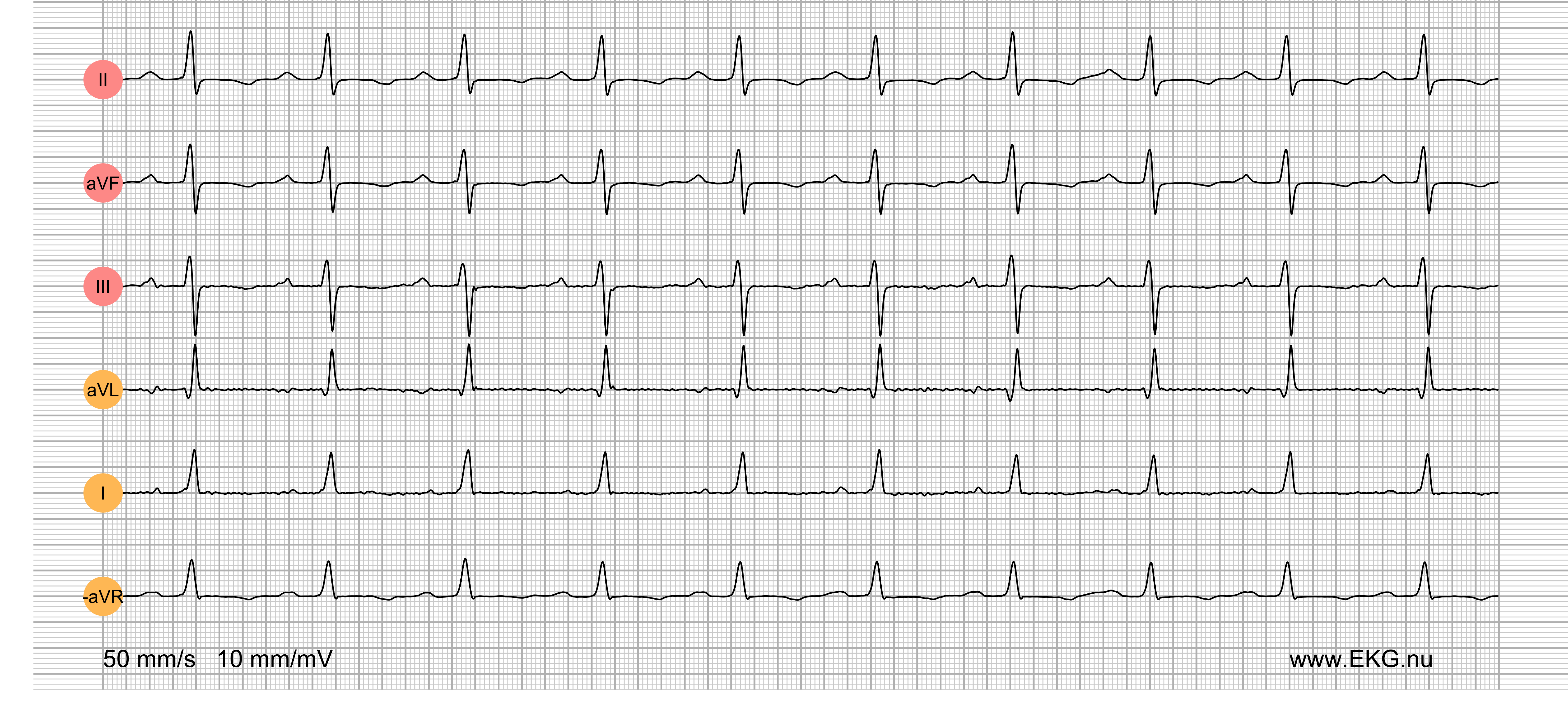 EKG test bok kurs 6b