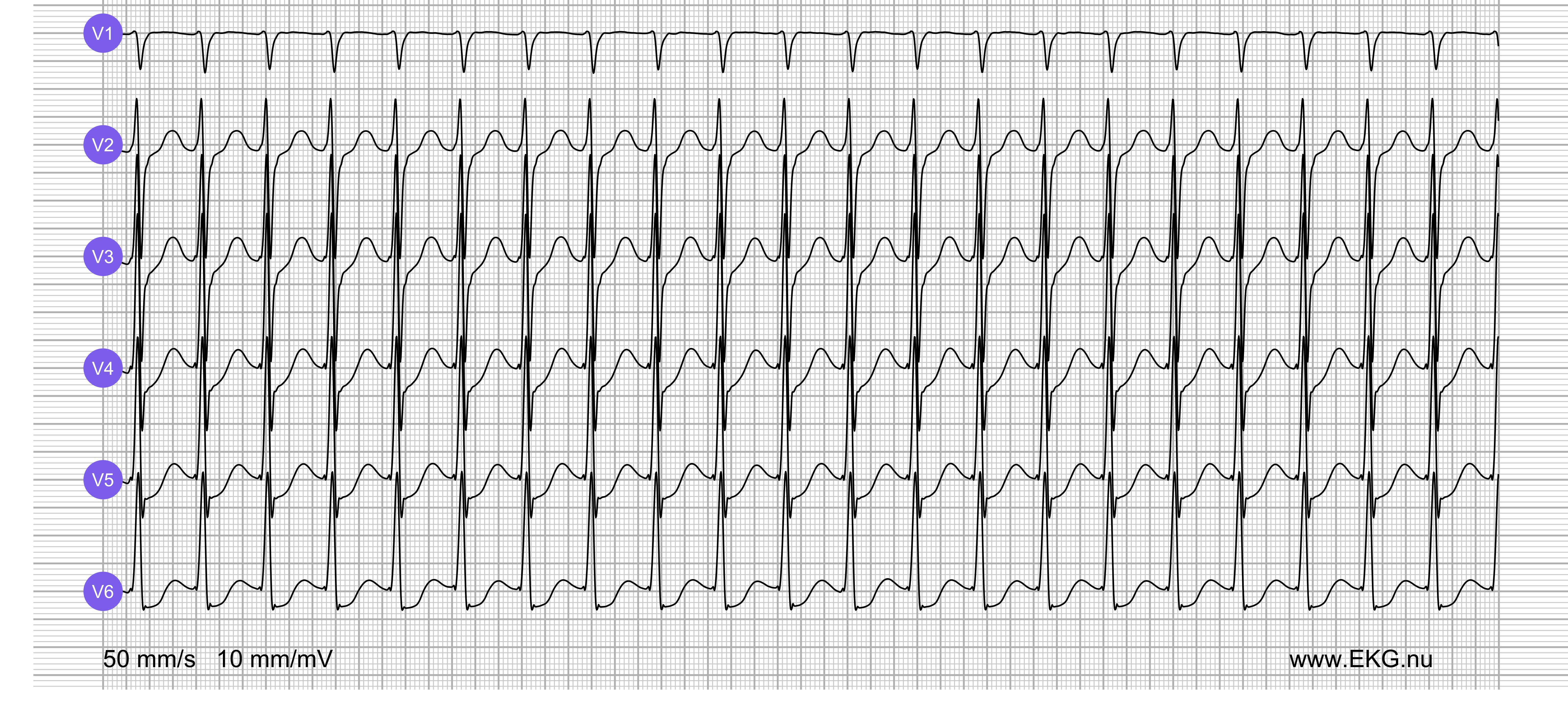 EKG test bok kurs 7a