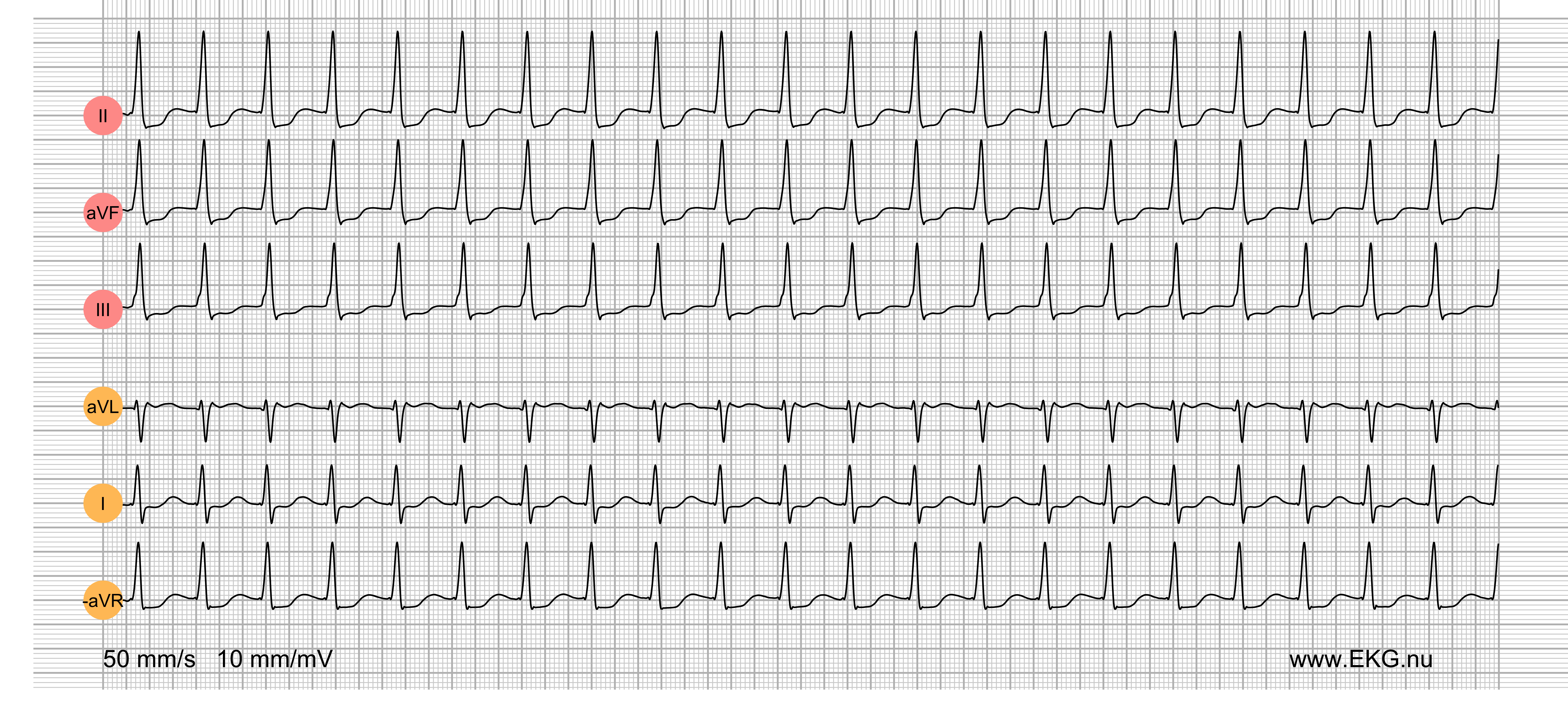 EKG test bok kurs 7b