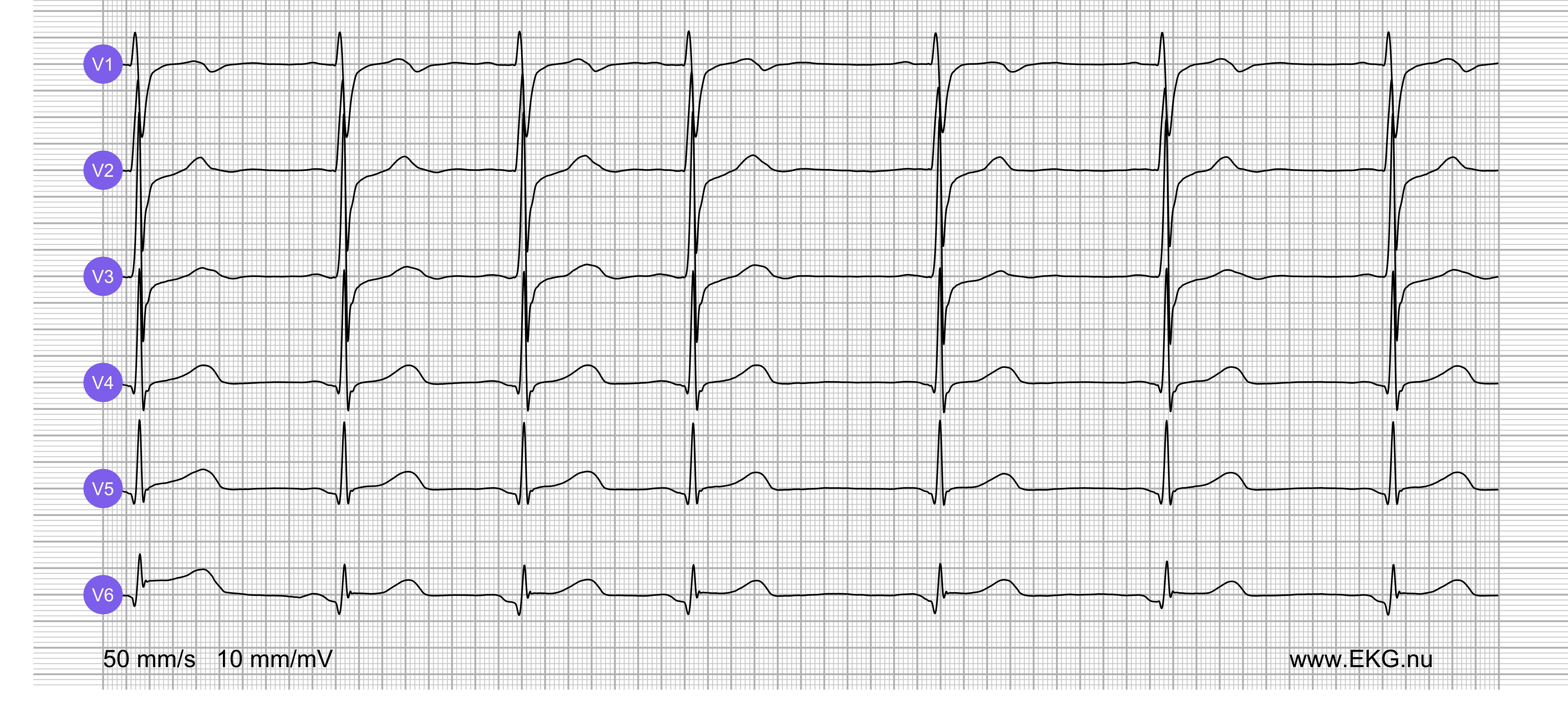 EKG test bok kurs 8a