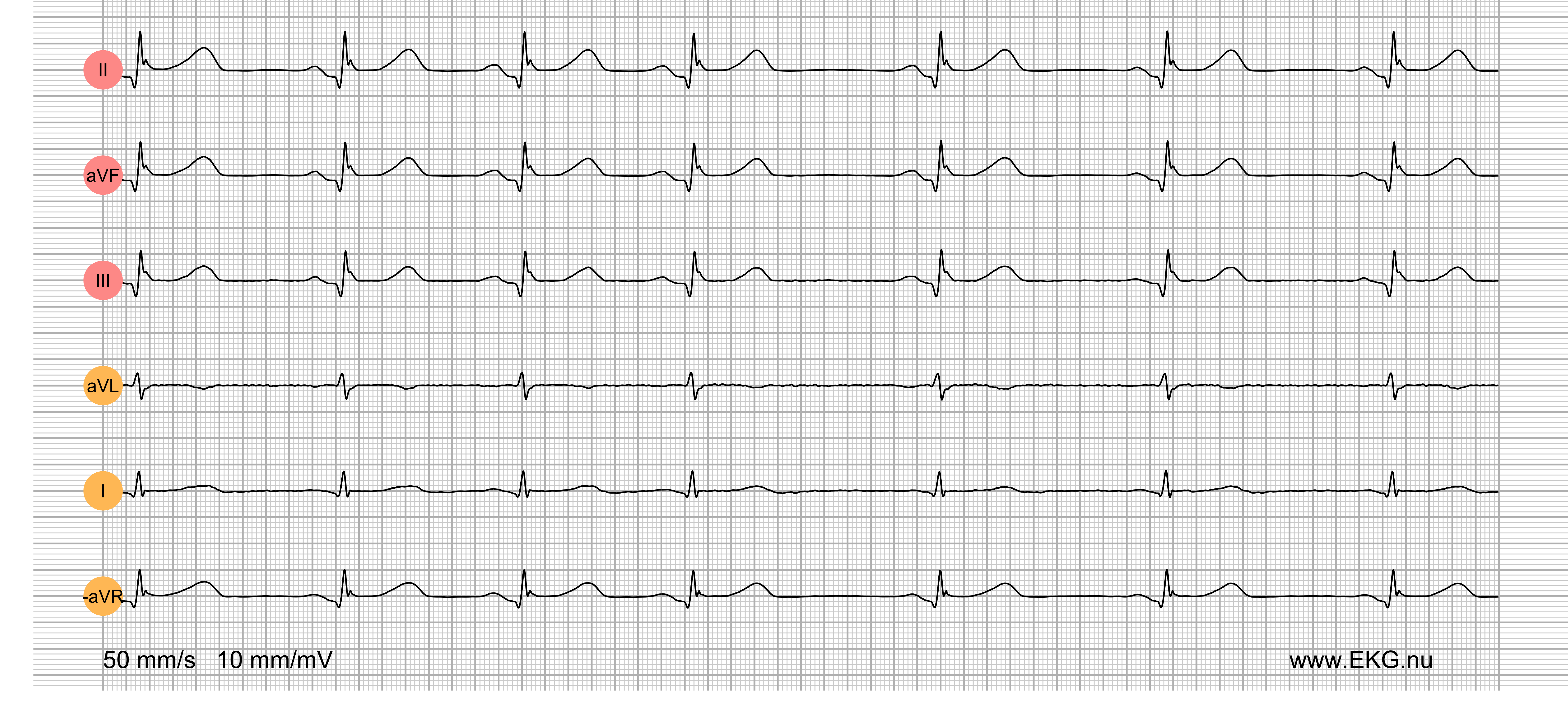 EKG test bok kurs 8b