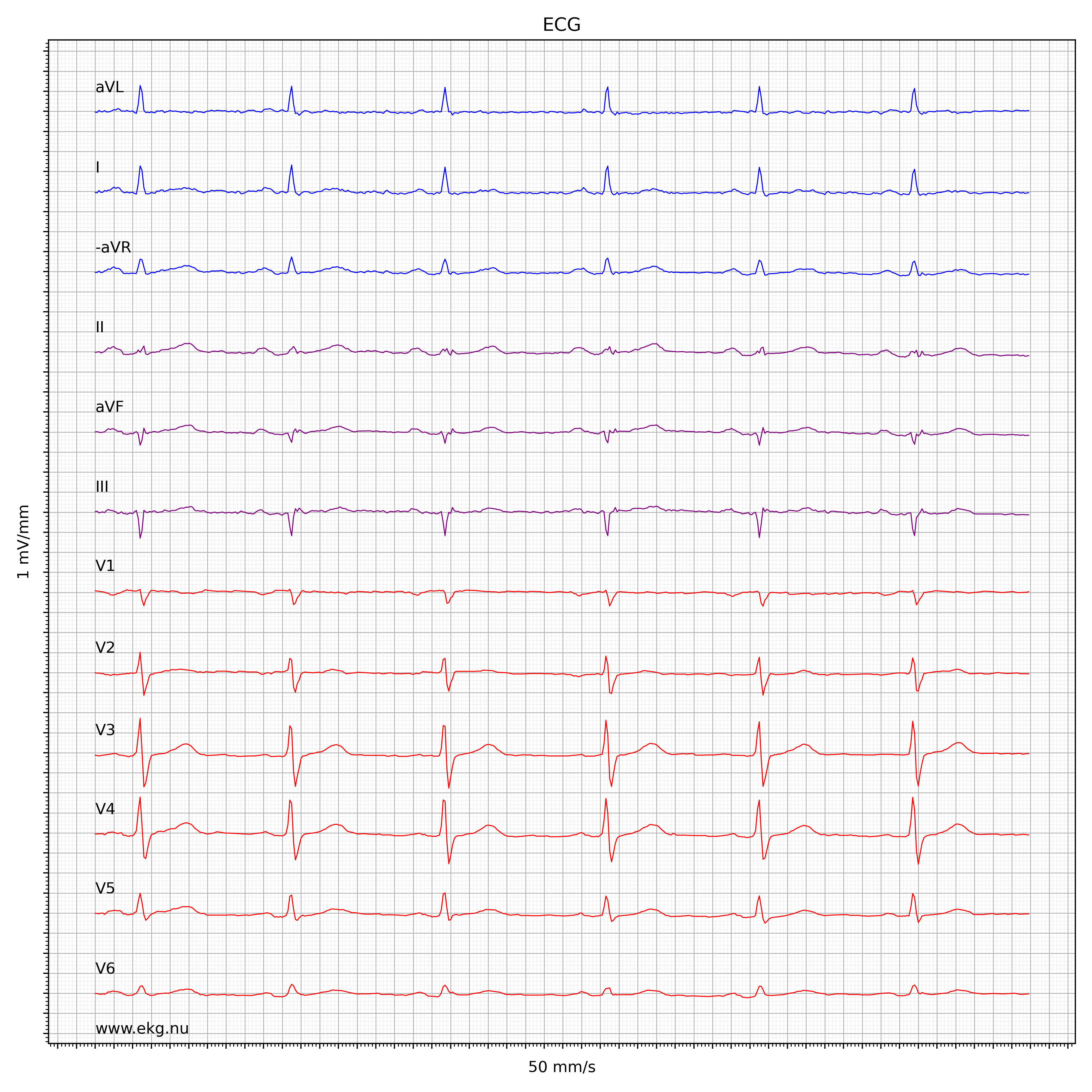 EKG test tolkning 3192155 1